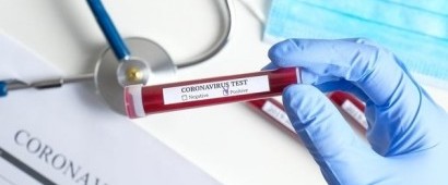 IRS Provides Guidance on COVID-19 Testing Coverage, HSAs & Associated HDHPs